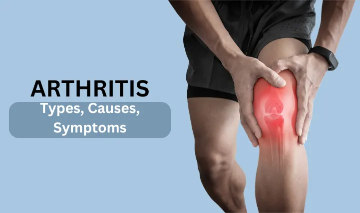 Arthritis (गठिया या जोड़ो का दर्द) Types, Causes, Symptoms