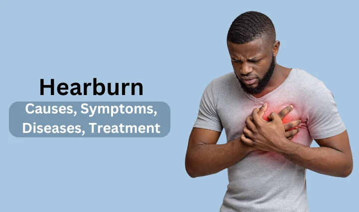 Hearburn causes, symptoms, diseases, treatment