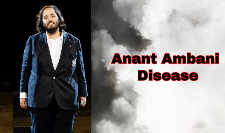 Anant Ambani Disease Condition, Treatment And Side Effects